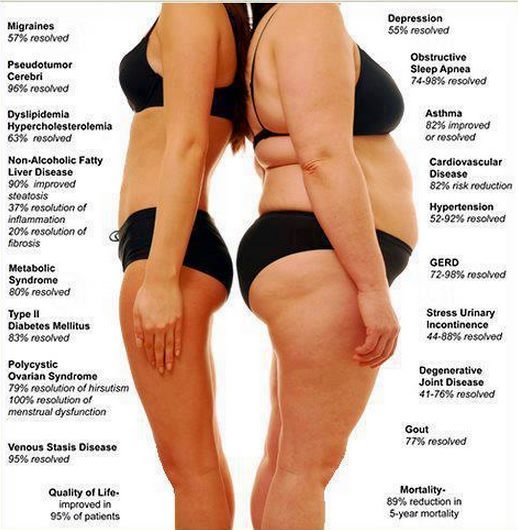You are currently viewing Pcos Diet Plan To Lose weight : Slim Down The Right way